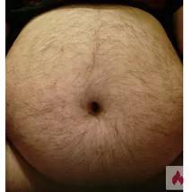 Sex treffen in Mönchengladbach 