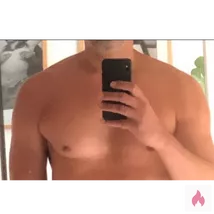 Prickel des Unbekannten (München & Umgebung)