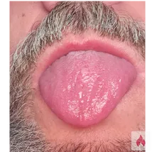 Heiße Lippen gesucht