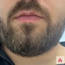 Biete mein Gesicht an 